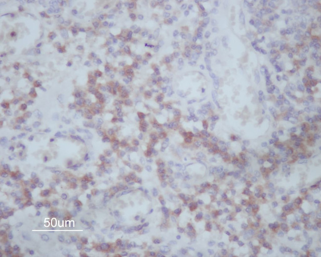 MMP14 Antibody in Immunohistochemistry (Paraffin) (IHC (P))