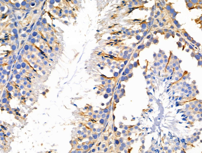 MMP14 Antibody in Immunohistochemistry (Paraffin) (IHC (P))