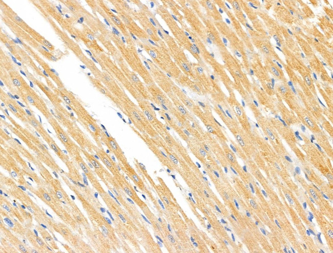 MMP14 Antibody in Immunohistochemistry (Paraffin) (IHC (P))