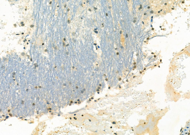 NKX3.1 Antibody in Immunohistochemistry (Paraffin) (IHC (P))