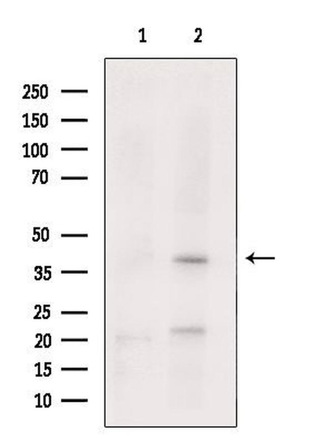 NKX3.1 Antibody in Western Blot (WB)