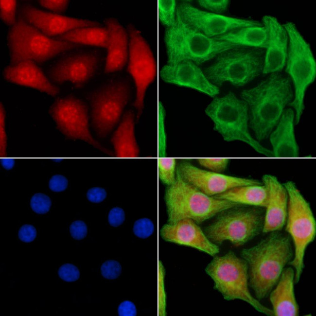 OCT2 Antibody in Immunocytochemistry (ICC/IF)