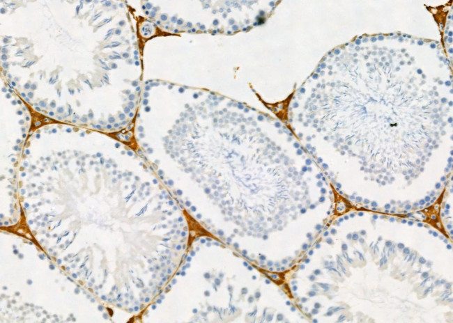 OCT2 Antibody in Immunohistochemistry (Paraffin) (IHC (P))