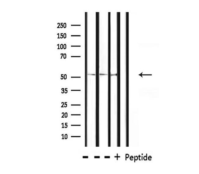 OCT2 Antibody in Western Blot (WB)