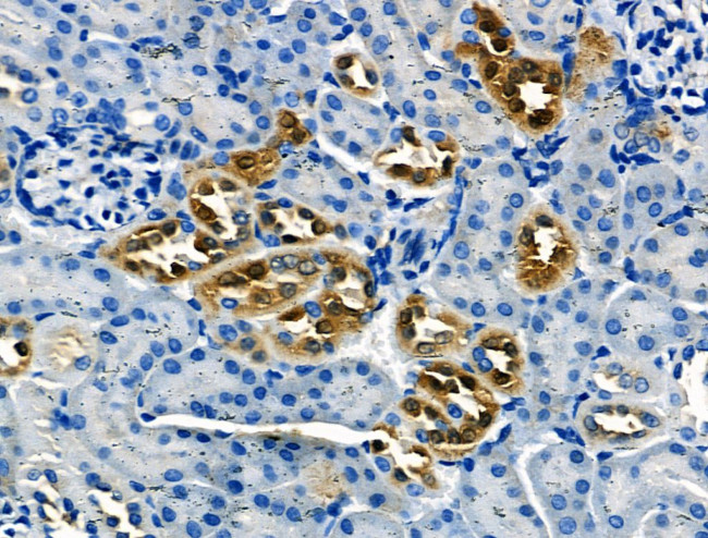 Pan Ras Antibody in Immunohistochemistry (Paraffin) (IHC (P))