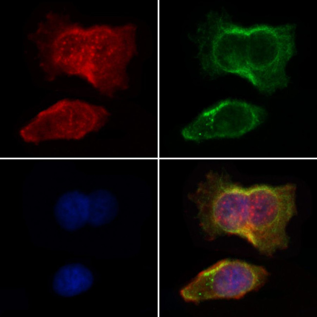 Pan Ras Antibody in Immunocytochemistry (ICC/IF)