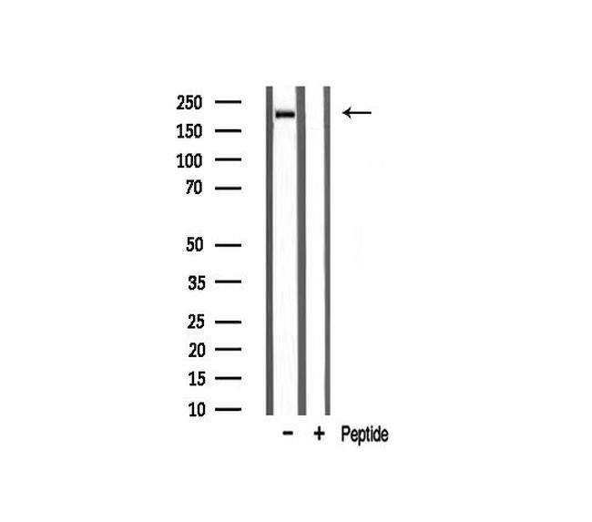 Sodium Channel Pan Antibody in Western Blot (WB)