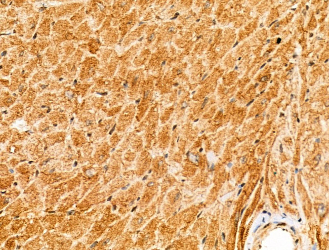 PIAS3 Antibody in Immunohistochemistry (Paraffin) (IHC (P))