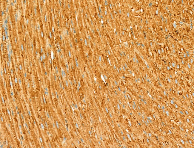 PIAS3 Antibody in Immunohistochemistry (Paraffin) (IHC (P))