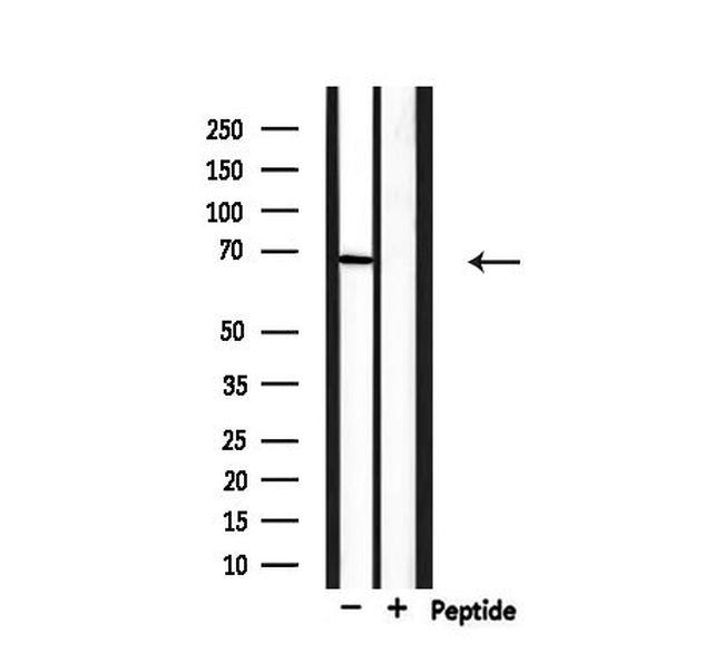 PIAS3 Antibody in Western Blot (WB)