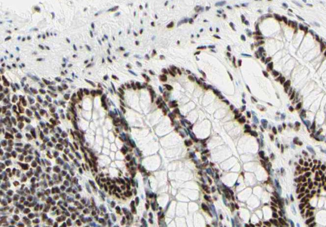 UBA2 Antibody in Immunohistochemistry (Paraffin) (IHC (P))