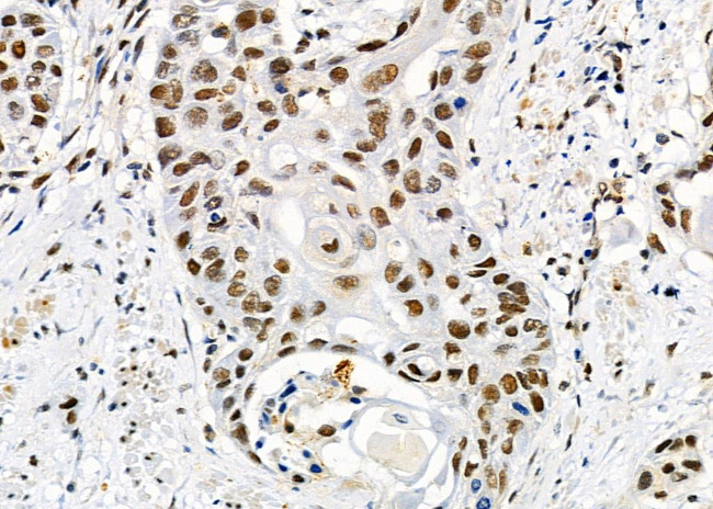 UBA2 Antibody in Immunohistochemistry (Paraffin) (IHC (P))