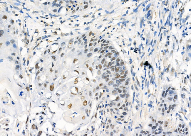 UBA2 Antibody in Immunohistochemistry (Paraffin) (IHC (P))