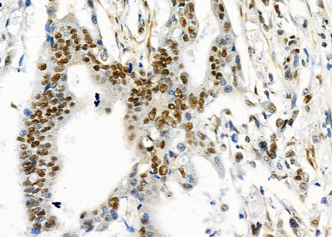 UBA2 Antibody in Immunohistochemistry (Paraffin) (IHC (P))