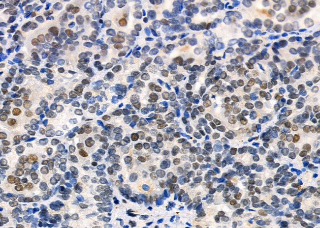 UBA2 Antibody in Immunohistochemistry (Paraffin) (IHC (P))