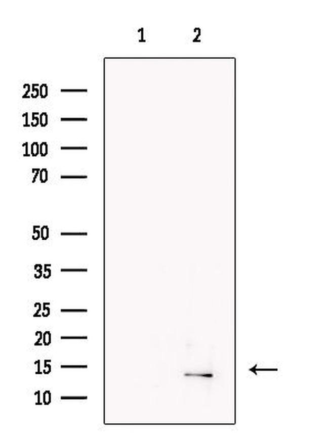 Urocortin Antibody in Western Blot (WB)