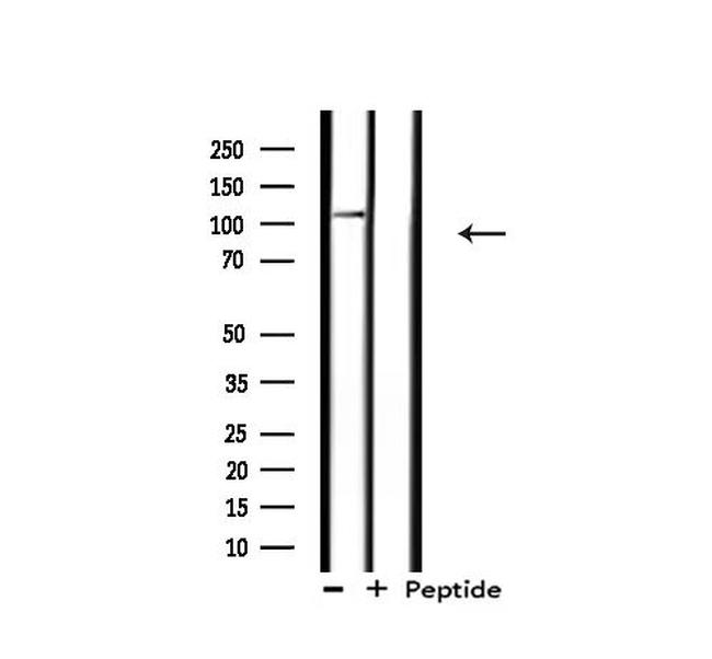 XPF Antibody in Western Blot (WB)