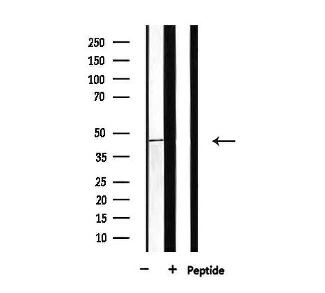 BCKDK Antibody in Western Blot (WB)