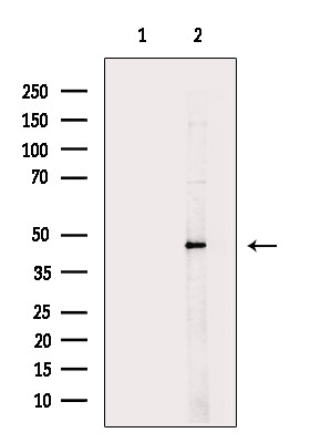 BCKDK Antibody in Western Blot (WB)