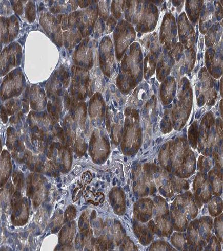 HGS Antibody in Immunohistochemistry (Paraffin) (IHC (P))