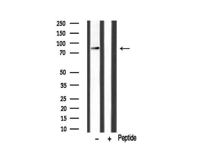 HGS Antibody in Western Blot (WB)