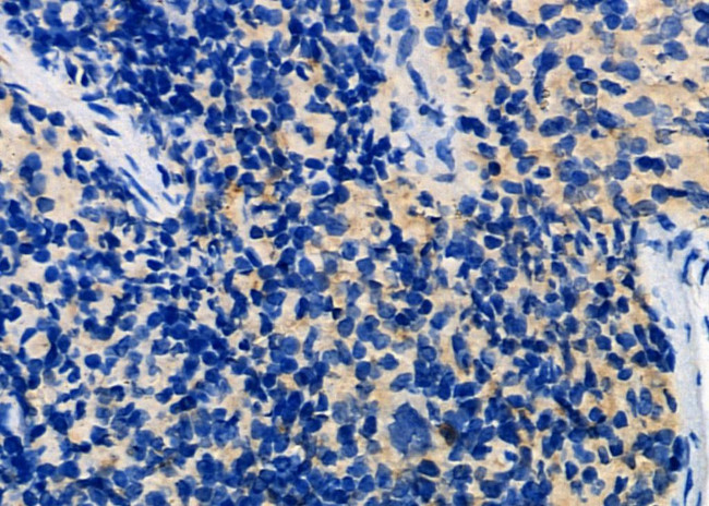 LIGHT Antibody in Immunohistochemistry (Paraffin) (IHC (P))