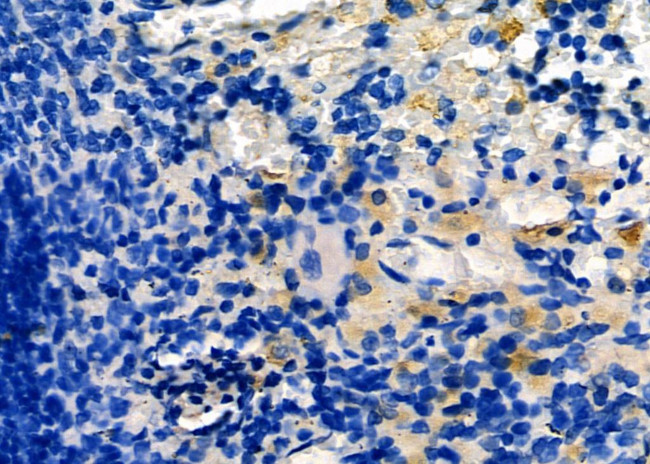 LIGHT Antibody in Immunohistochemistry (Paraffin) (IHC (P))