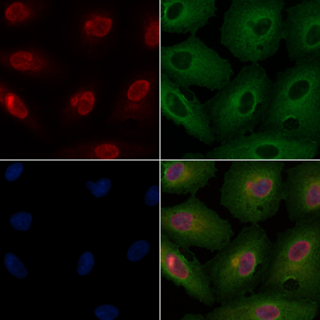 AKAP8 Antibody in Immunocytochemistry (ICC/IF)