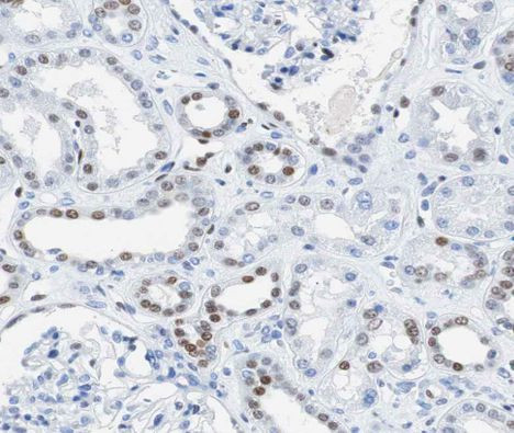 AKAP8 Antibody in Immunohistochemistry (Paraffin) (IHC (P))