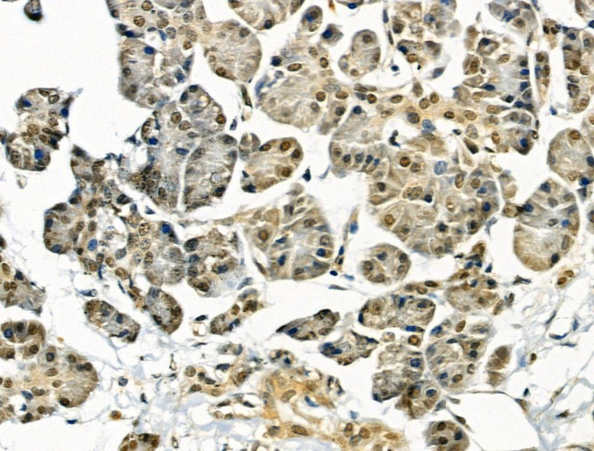 AKAP8 Antibody in Immunohistochemistry (Paraffin) (IHC (P))