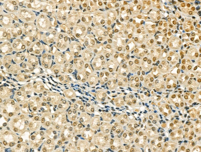 AKAP8 Antibody in Immunohistochemistry (Paraffin) (IHC (P))