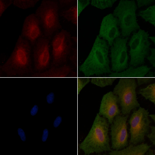 KIP2 Antibody in Immunocytochemistry (ICC/IF)