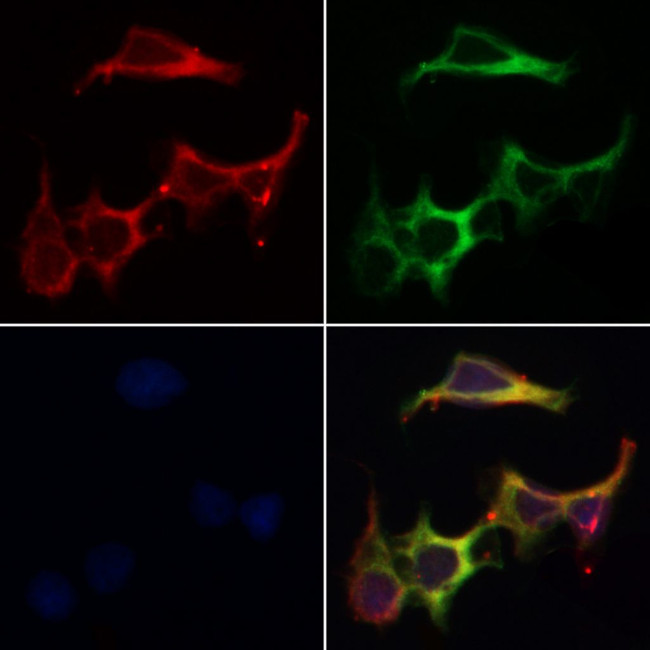 KIP2 Antibody in Immunocytochemistry (ICC/IF)