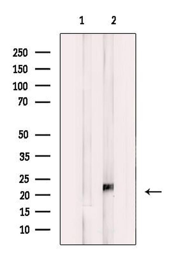 KIP2 Antibody in Western Blot (WB)