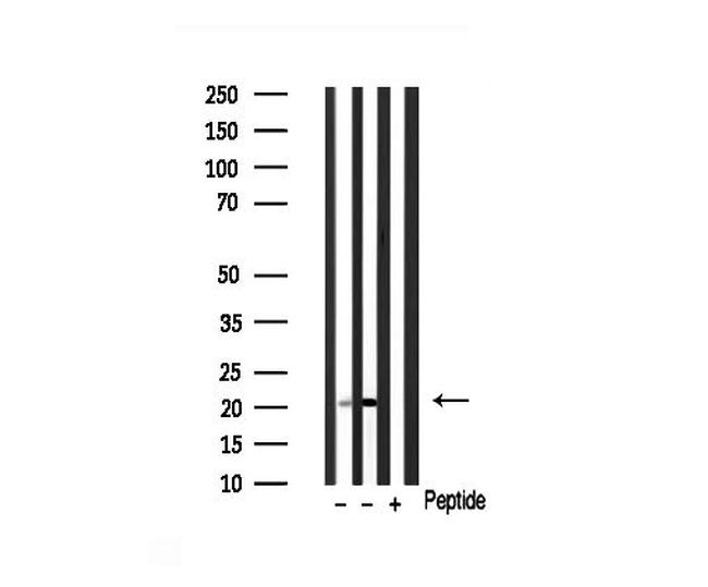 KIP2 Antibody in Western Blot (WB)