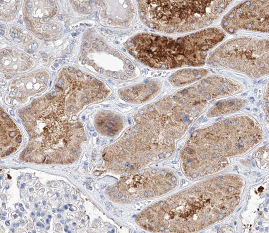 TRIM16 Antibody in Immunohistochemistry (Paraffin) (IHC (P))