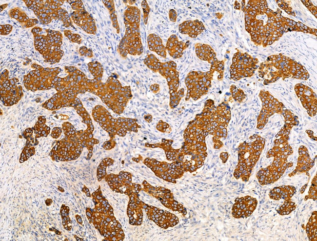 TRIM16 Antibody in Immunohistochemistry (Paraffin) (IHC (P))