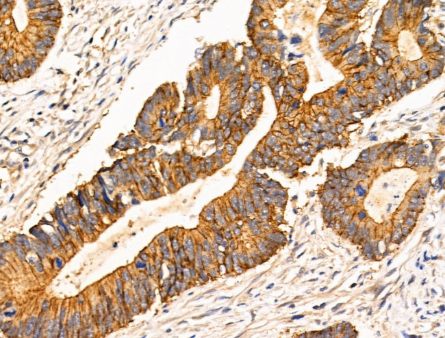 TRIM16 Antibody in Immunohistochemistry (Paraffin) (IHC (P))