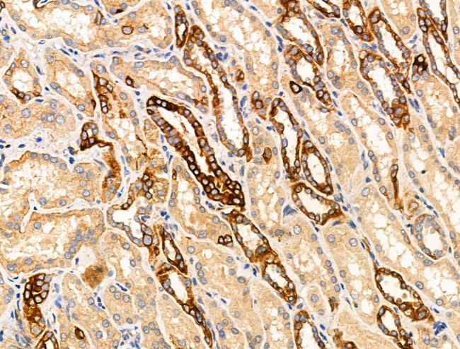 TRIM16 Antibody in Immunohistochemistry (Paraffin) (IHC (P))