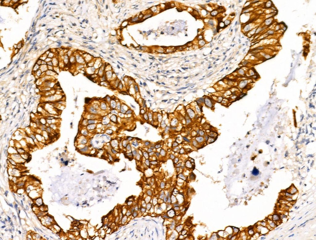 TRIM16 Antibody in Immunohistochemistry (Paraffin) (IHC (P))