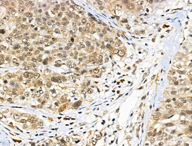 ATRX Antibody in Immunohistochemistry (Paraffin) (IHC (P))