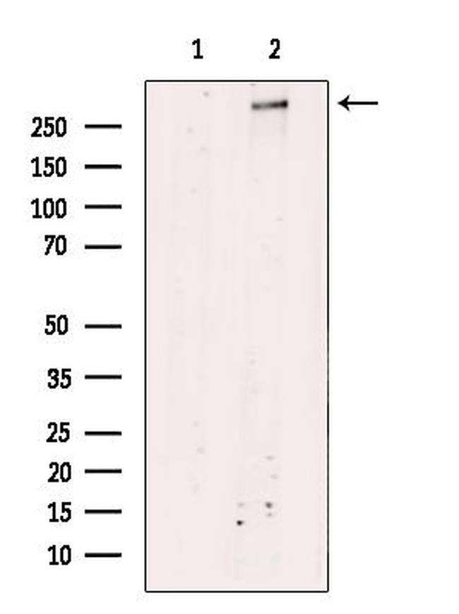 ATRX Antibody in Western Blot (WB)