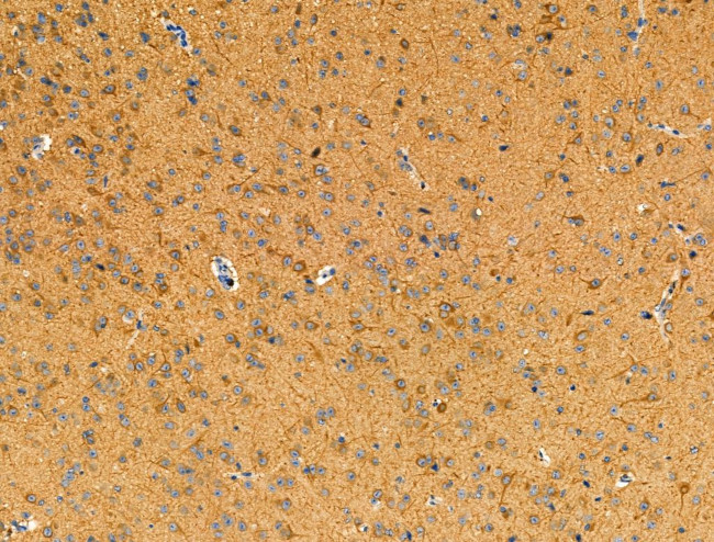 DUS2L Antibody in Immunohistochemistry (Paraffin) (IHC (P))