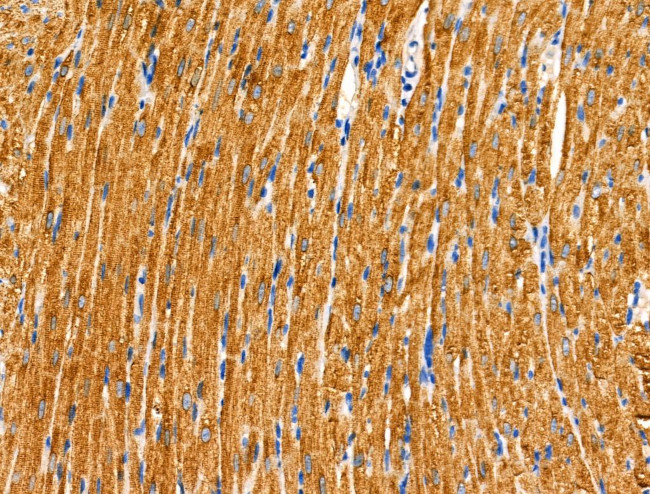 DUS2L Antibody in Immunohistochemistry (Paraffin) (IHC (P))