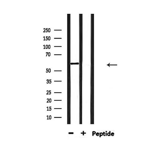 YTHDF1 Antibody in Western Blot (WB)