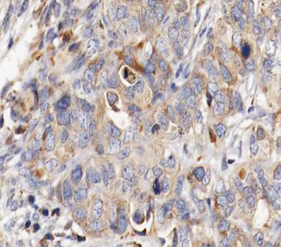 MUC13 Antibody in Immunohistochemistry (Paraffin) (IHC (P))