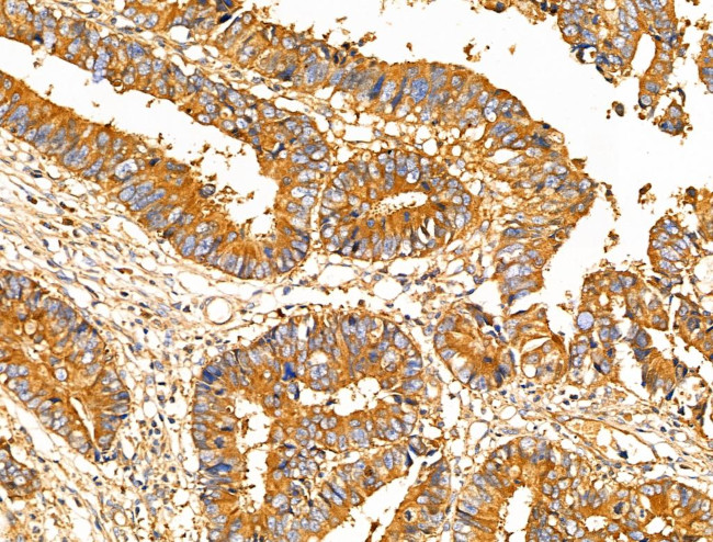 MUC13 Antibody in Immunohistochemistry (Paraffin) (IHC (P))