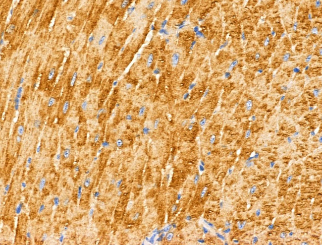 MUC13 Antibody in Immunohistochemistry (Paraffin) (IHC (P))