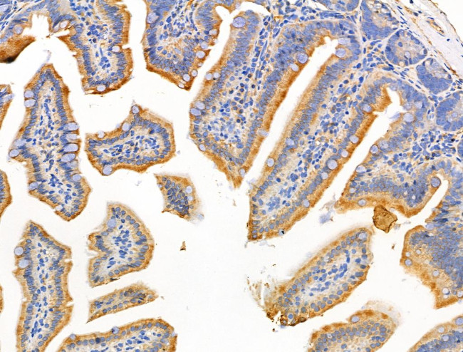 MUC13 Antibody in Immunohistochemistry (Paraffin) (IHC (P))