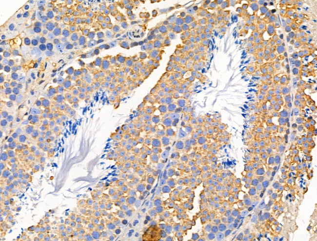 MUC13 Antibody in Immunohistochemistry (Paraffin) (IHC (P))